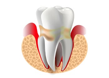 periodontics